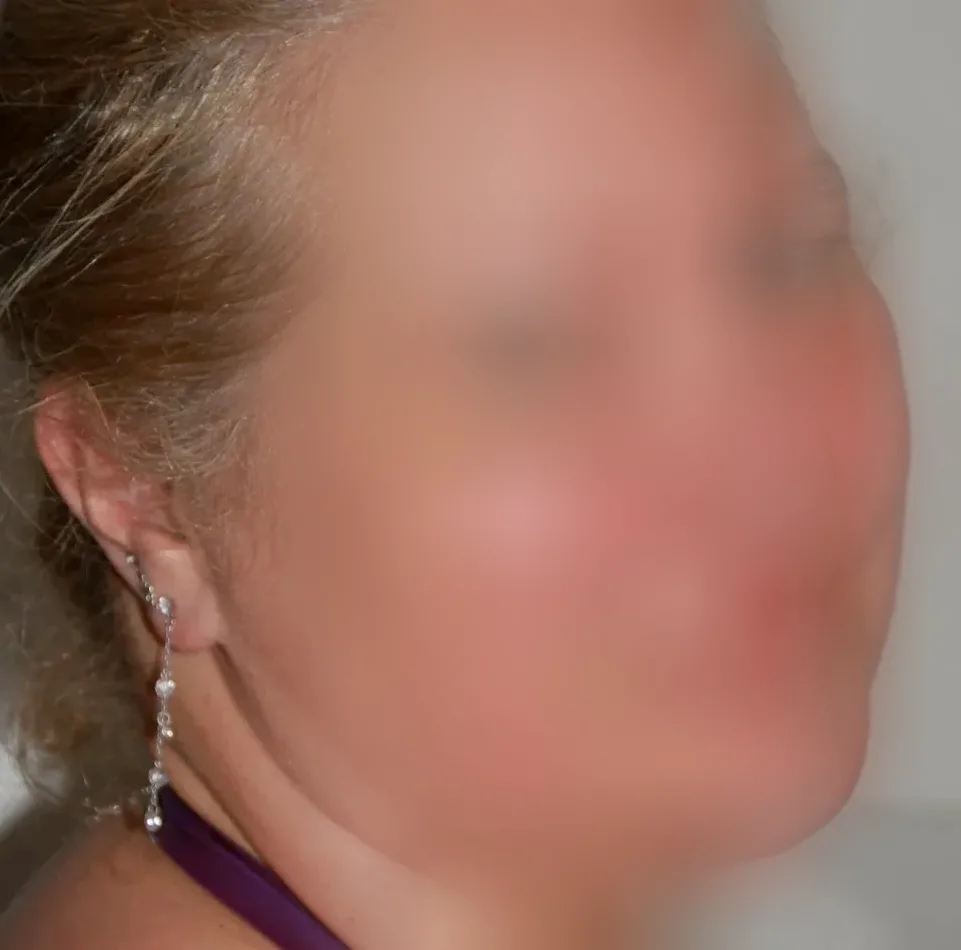 Susanne, 28